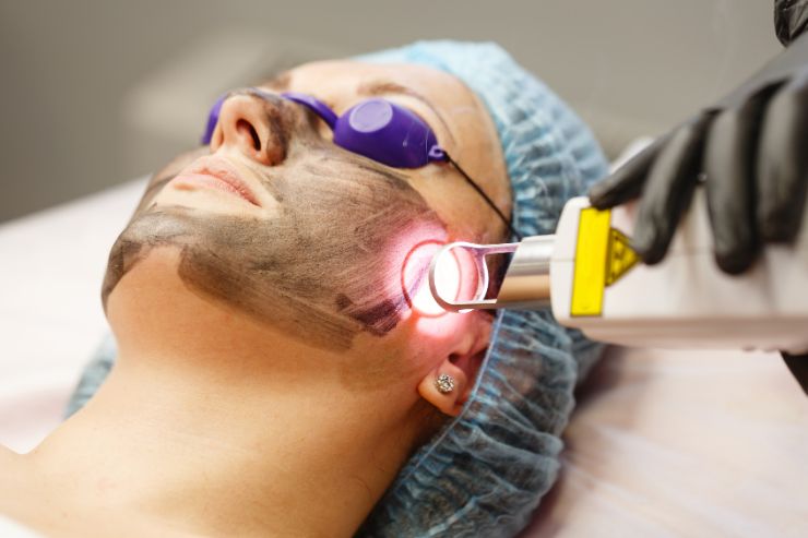 Laser Skin Resurfacing