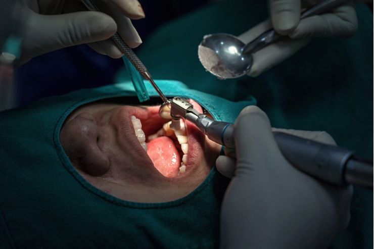 Oral-Surgery